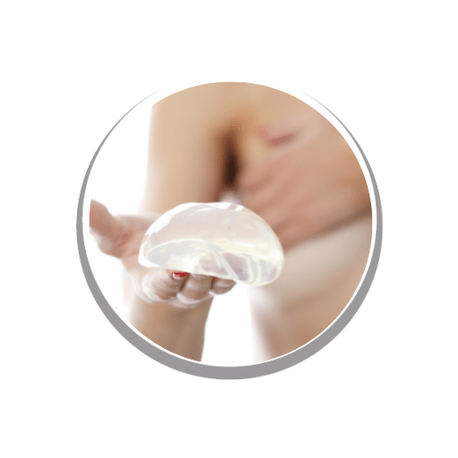 retirada implante mamario bilbao