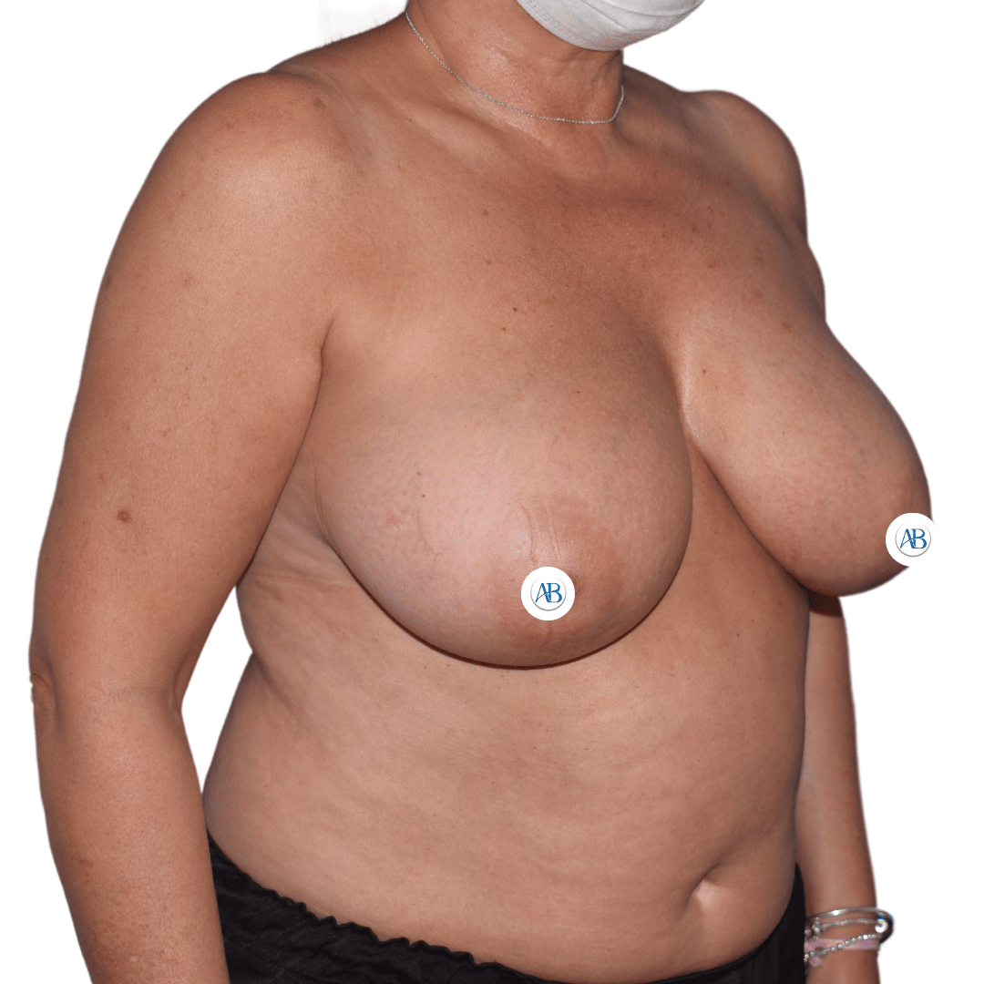 cirujano plastico mejor valorado