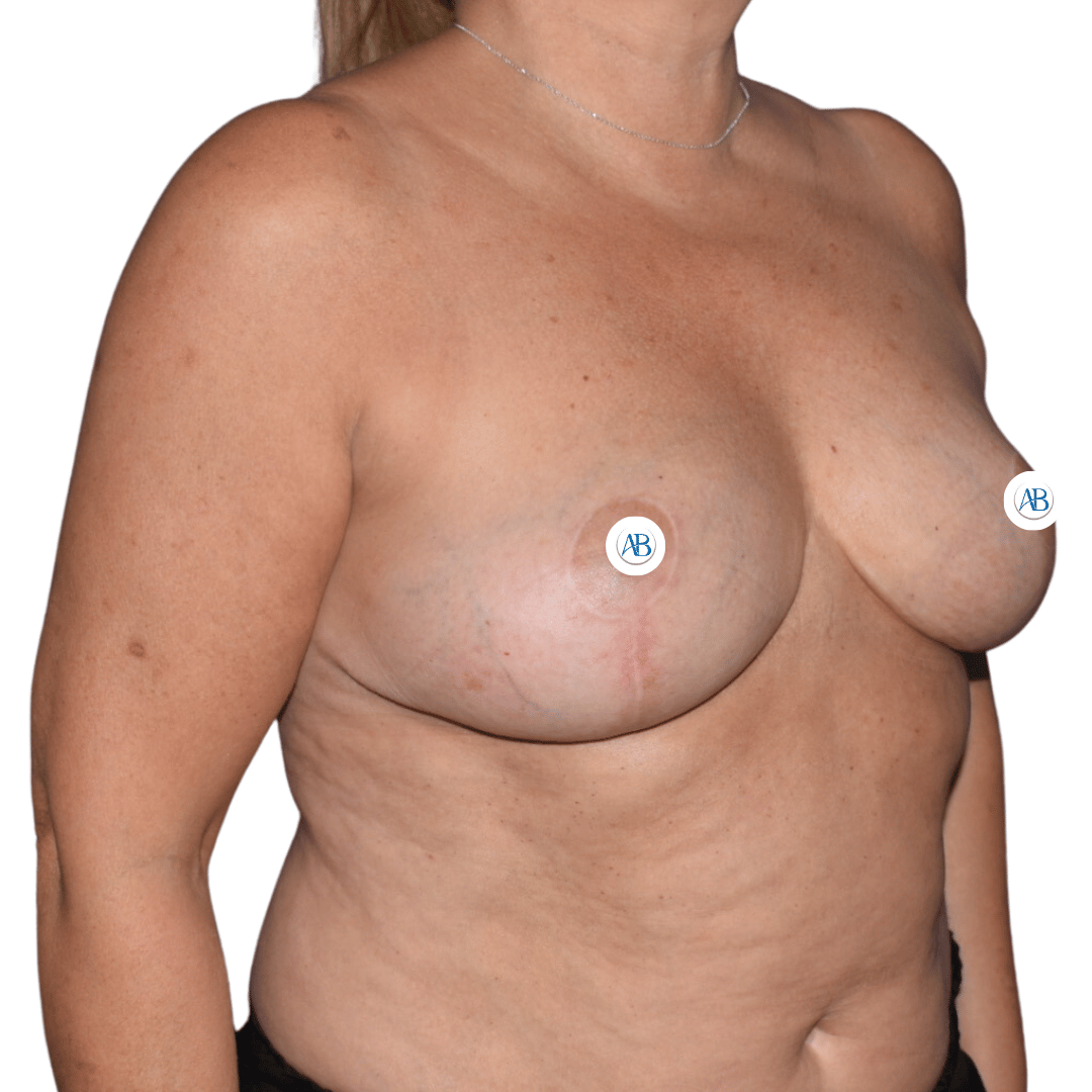 valoraciones cirujano plastico